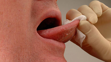 Mouth Cancer Screening